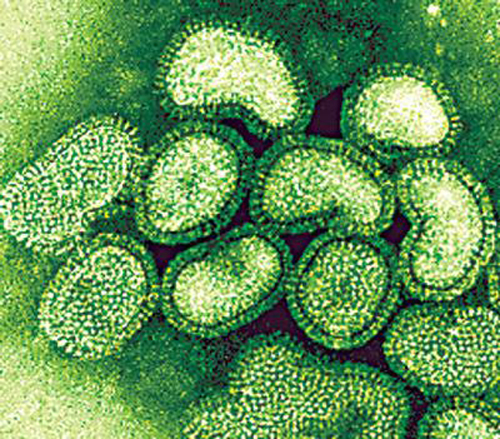H1N1 ვირუსით სომხეთში 4 ადამიანი დაიღუპა
