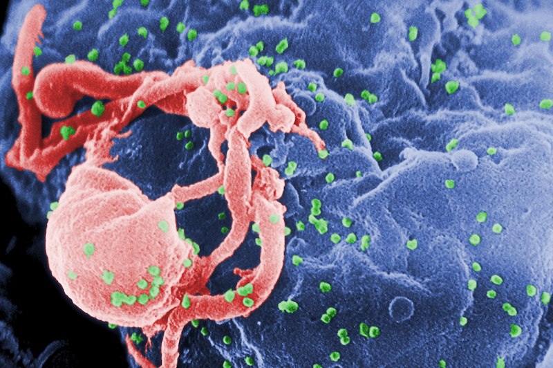 ისტორიაში პირველად მეცნიერებმა ცხოველის გენომიდან HIV გააქრეს